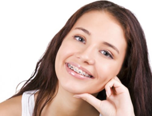 The Right Time for Braces, Part 1