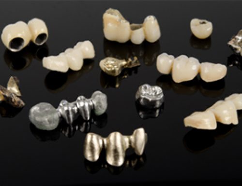 Crowns: Dental Workhorses