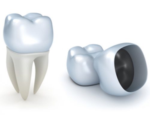 Crown Considerations