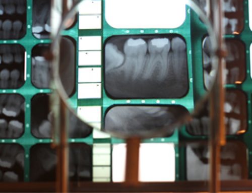 How Valuable are Dental X-Rays, Really?
