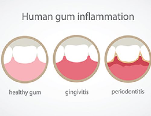 Baby Those Gums and Help Your Heart!