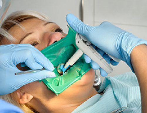The Rubber Dental Dam