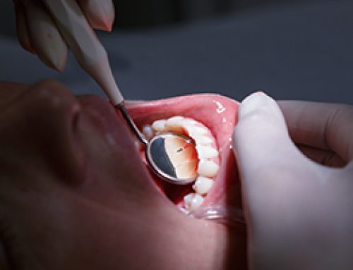 Your Mouth Says A Lot at Your Checkup