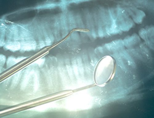 X-Rays From Our Perspective