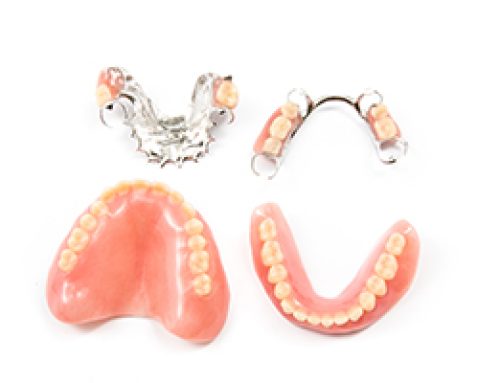 When a Tooth Goes Missing