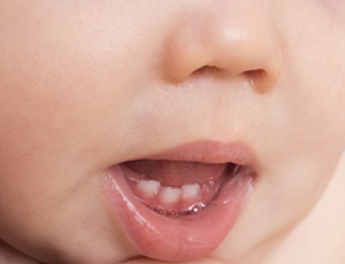 Preventing Cavities in Your Baby’s Teeth