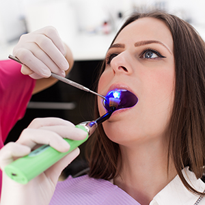 Woman Getting Cavity Filled