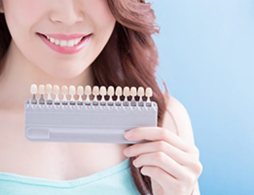 Choosing Teeth Whitening